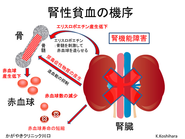 腎臓貧血の機序