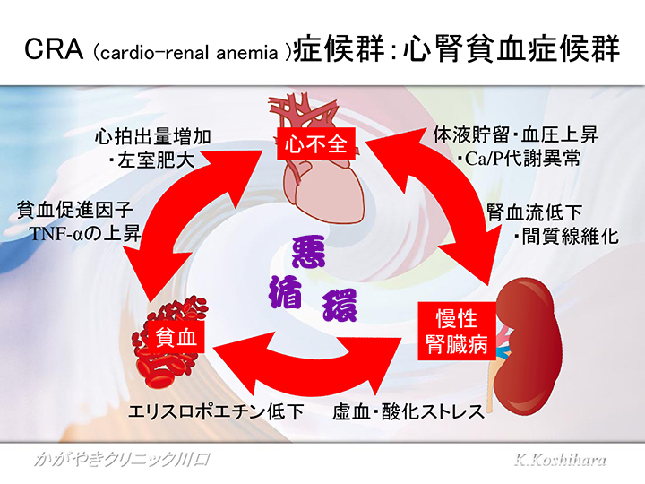 CRA (cardio-renal anemia )症候群：心腎貧血症候群